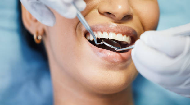 Best Emergency Wisdom Teeth Removal in Solon, IA